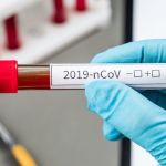 Αγνοείται διθέσιο εκπαιδευτικό αεροσκάφος-Είχε απογειωθεί από την Κοζάνη