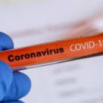 Κοροναϊός : 1.113 νέα κρούσματα και 29 θάνατοι – Στους 249 οι διασωληνωμένοι-17 στην Περιφέρεια