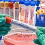 «Βόμβα ΣτΕ»: Αντισυνταγματικές οι διατάξεις Θεοδωρικάκου για τις Επιτροπές των Δήμων